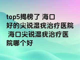 top5揭榜了 海口好的尖锐湿疣治疗医院 海口尖锐湿疣治疗医院哪个好